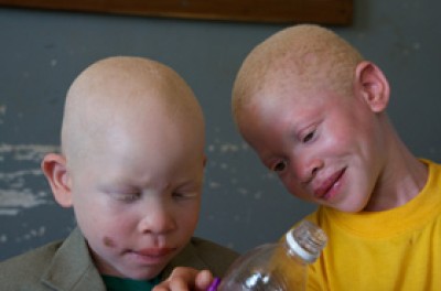 hrc_advisory_comittee_albinism_hp