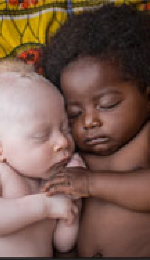 三周大的白化病新生儿巴斯乌噶（Basunga）和他的表哥一起睡着 © 帕特丽夏•伟洛克